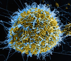 Cellula infettata dal virus ebola