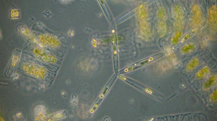 La microalga Nitzschia stellata