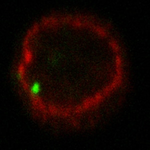 La sezione di un nucleo di linfocita T umano infettato con HIV. In verde è marcato il genoma virale, e in rosso i pori nucleari che appaiono come un anello corrispondente alla membrana nucleare