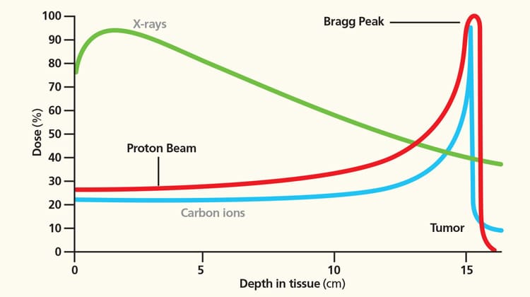 Andamento della dose rilasciata a profondità crescenti nel corpo del paziente da: curva verde, fotoni (radioterapia convenzionale), curva rossa, protoni, e curva azzurra, ioni carbonio (adroterapia)
