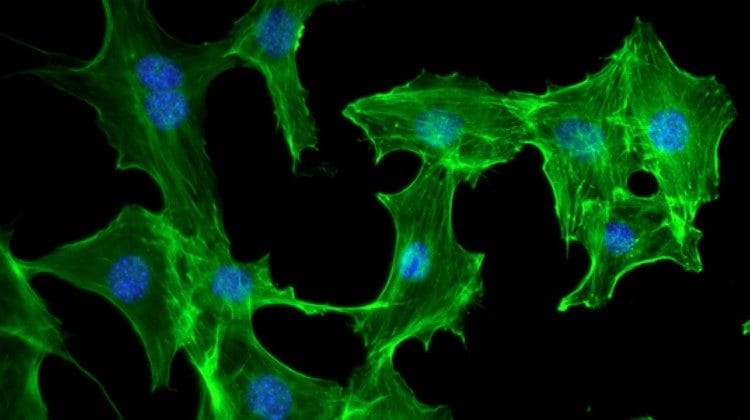 Fibroblasti murini osservati al microscopio a fluorescenza: in blu sono visibili i nuclei, in verde l’actina, che è uno dei principali costituenti del citoscheletro cellulare