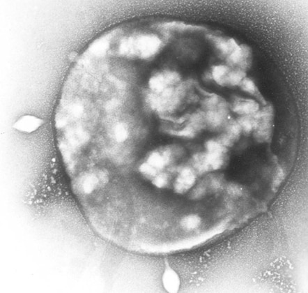 Sulfolobus solfataricus, infettato da virus, visto al microscopio